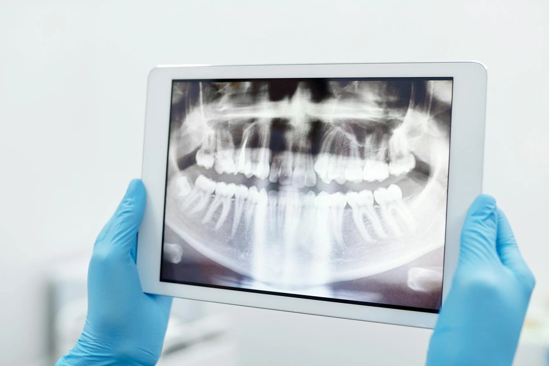 Dental X-ray scan on tablet